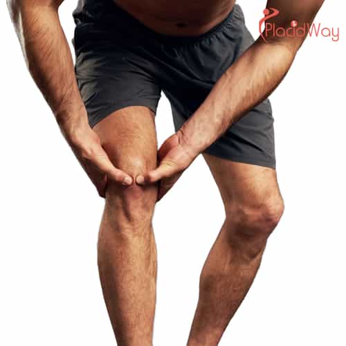 6 Things to Know About ACL, Meniscus & Sports Surgery in Tijuana